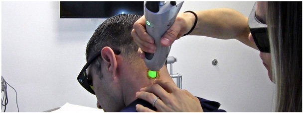 Laser Hair Removal for men at Contour Dermatology